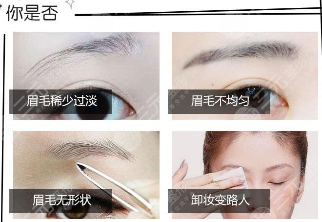 北京繡眉價格