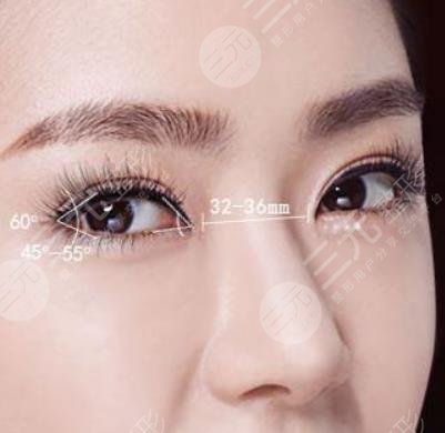 開眼角手術(shù)的價(jià)格