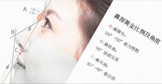 肥厚鼻尖矯正