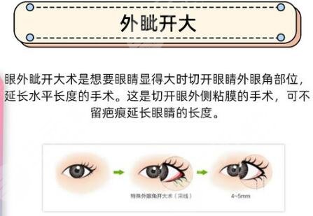 開外眼角?