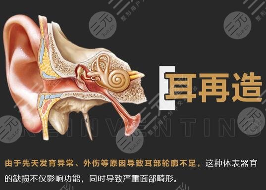 耳再造多少費(fèi)用？?jī)r(jià)格參考&手術(shù)科普，耳整形避雷指南！