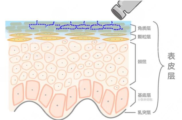 什么是熱瑪吉除皺
