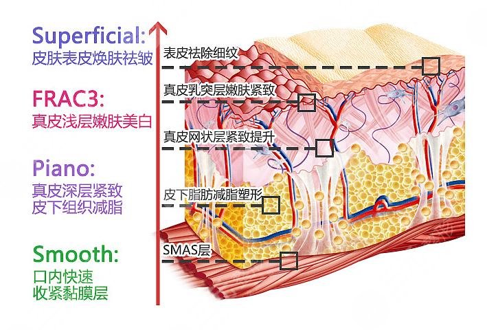 歐洲之星4D比熱瑪吉好嗎?