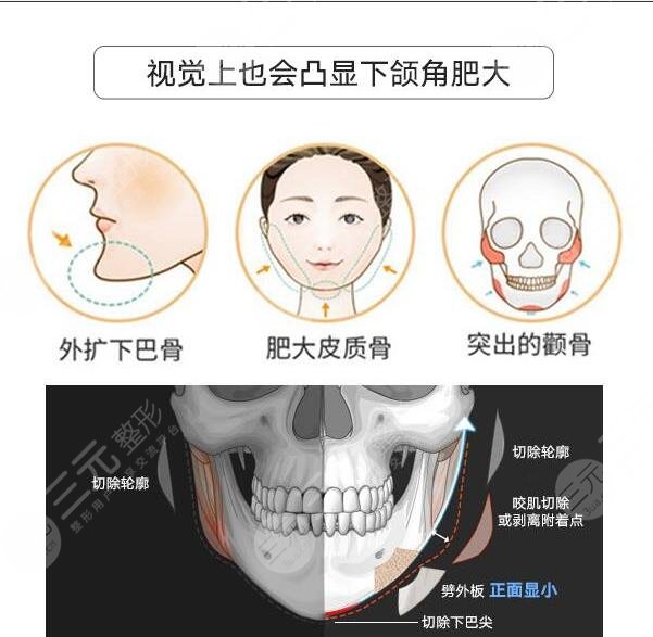 改臉型手術(shù)過(guò)程