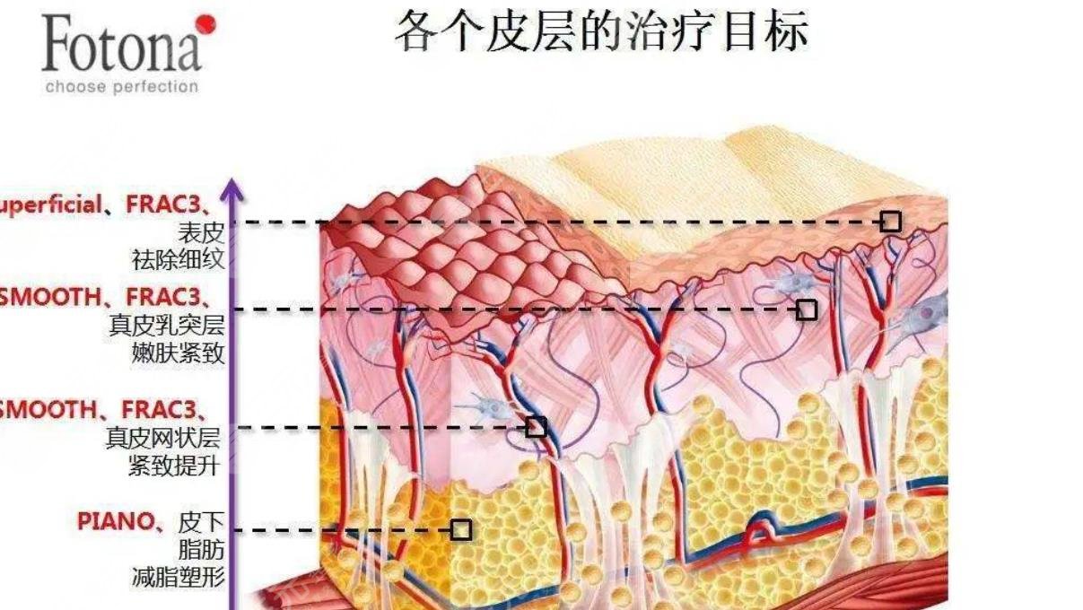 歐洲之星fotona