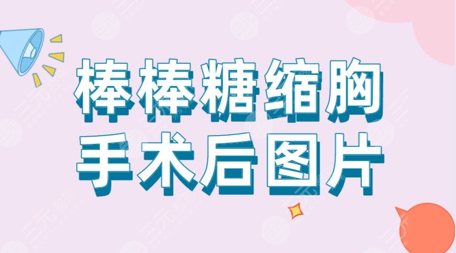棒棒糖縮胸手術(shù)后圖片！手術(shù)過(guò)程是怎樣的？風(fēng)險(xiǎn)大嗎？附價(jià)格表