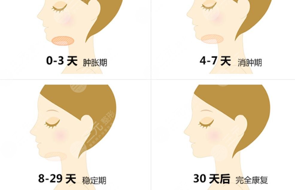 雙下巴