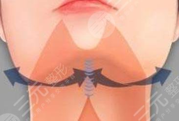 雙下巴