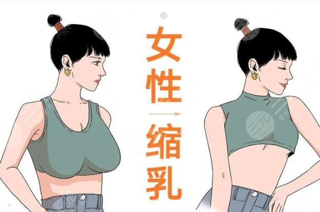 為什么要做縮胸手術(shù)