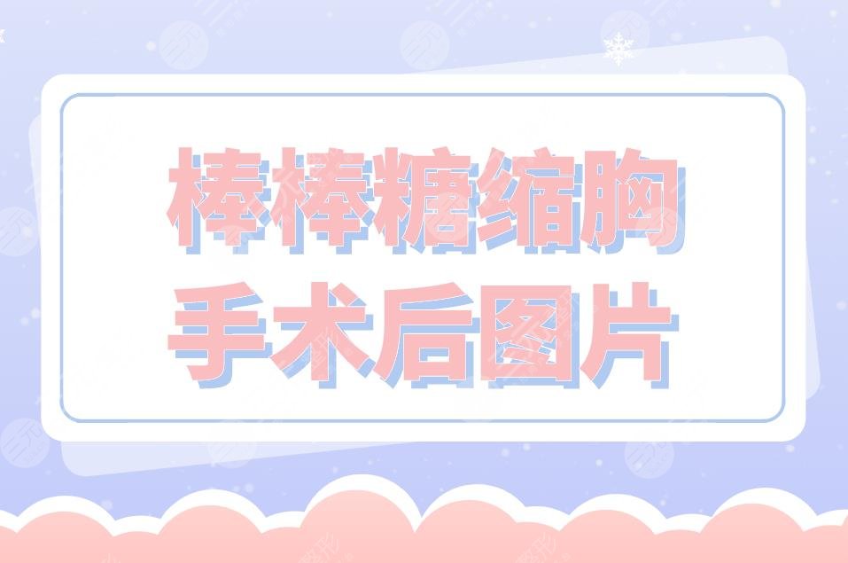 棒棒糖縮胸手術后圖片分享！附手術原理介紹+手術注意事項