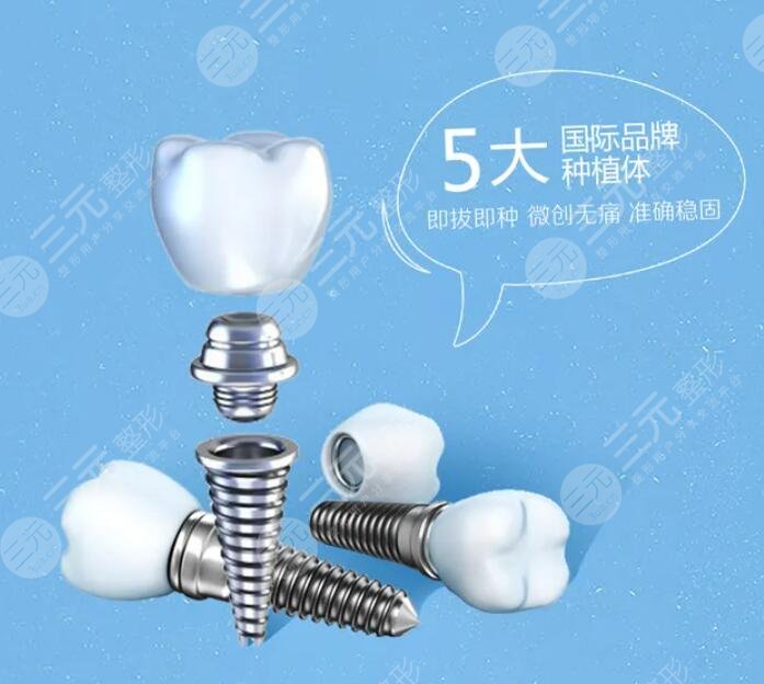 種植牙技術(shù)的價格