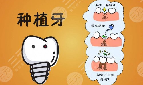 德國牙齒種植體品牌有哪些呢