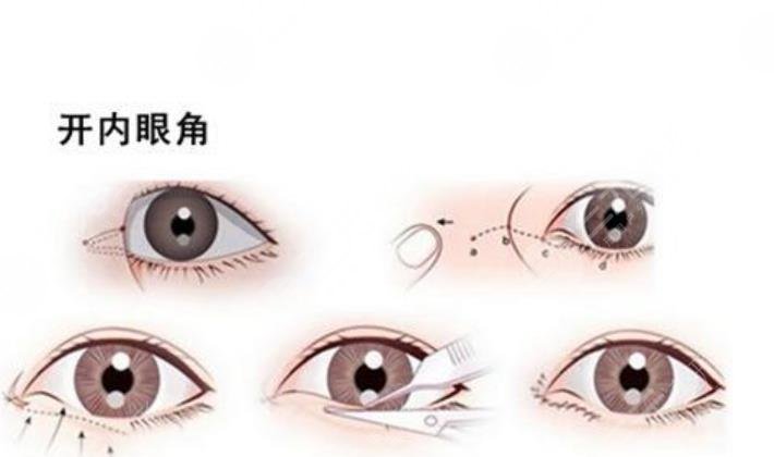 開眼角