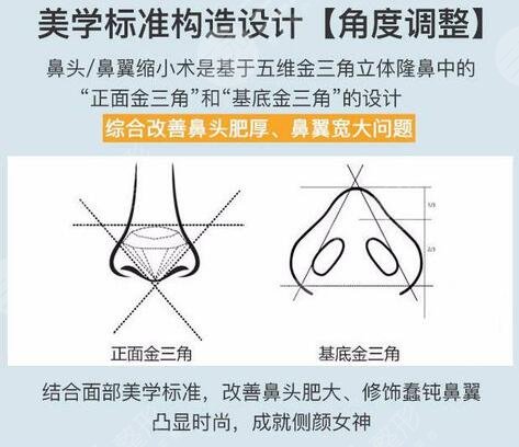 鼻翼縮小手術(shù)費(fèi)用大概是多少錢，降低風(fēng)險(xiǎn)嗎？?jī)r(jià)格參考&術(shù)后護(hù)理指南！