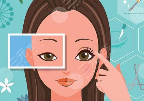 10個開內(nèi)眼角9個留疤怎么辦？怎么避免開眼角留疤？注意事項帶你了解！