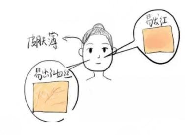 紅血絲