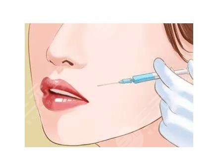 天津醫(yī)院整形外科面部吸脂案例