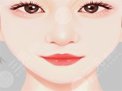 v-line改臉型瘦臉整形手術(shù)案例恢復(fù)全過程對比圖