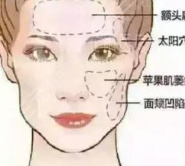斯美諾整形面b提升怎樣？術后果對比反饋