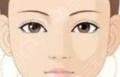 美瞳線第一天