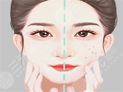 聽說“顱耳角在30°-60°之間”火爆全網？說說我做顱耳角在30°-60°之間注射整形的感受吧~