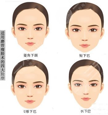 [顴骨整形術(shù)的價(jià)格貴不貴?]