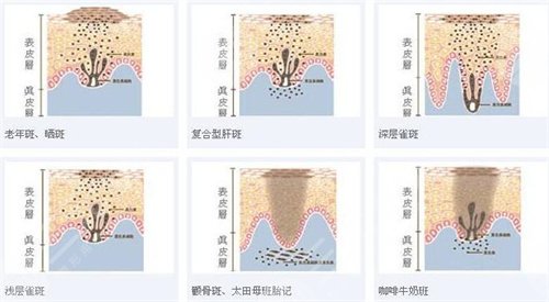 東莞康華醫(yī)院皮膚科收費情況