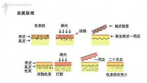 東莞康華醫(yī)院皮膚科收費情況