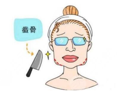 磨下頜角手術(shù)經(jīng)歷