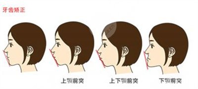 2020江蘇省口腔醫(yī)院價格表
