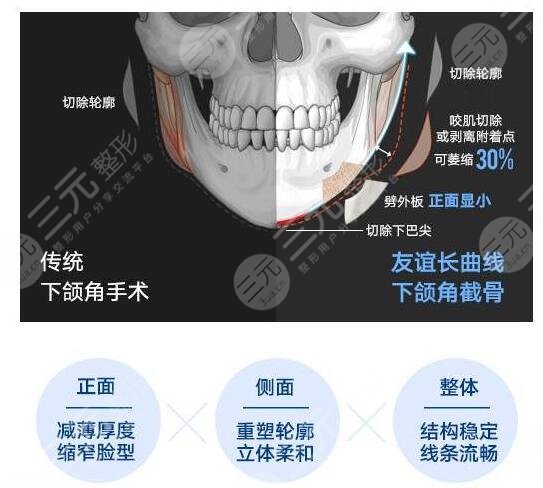 下頜角