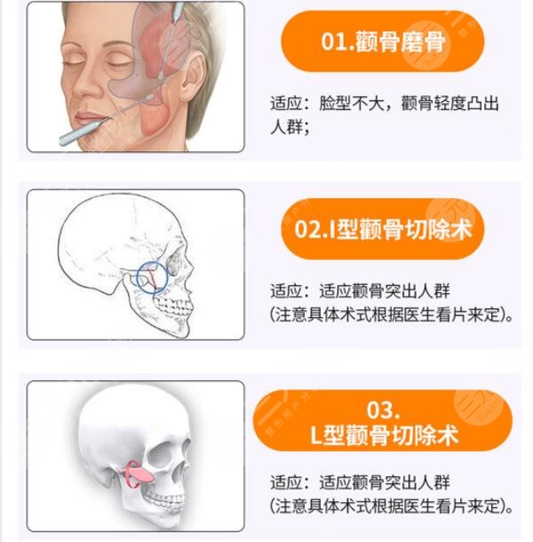 磨骨改臉型
