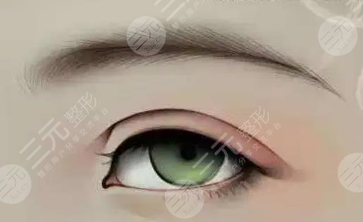 眉毛種植