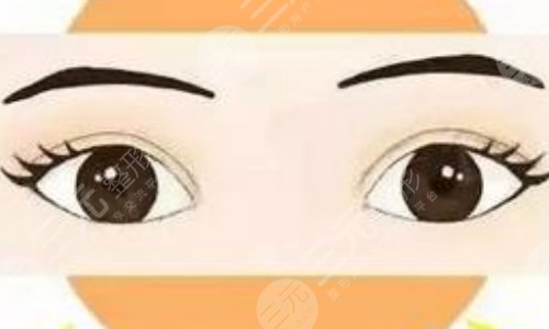 黃金龍醫(yī)生擅長項(xiàng)目介紹：雙眼皮