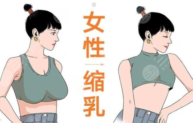 棒棒糖縮胸手術(shù)多少天完全消腫？