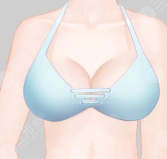 乳房縮小