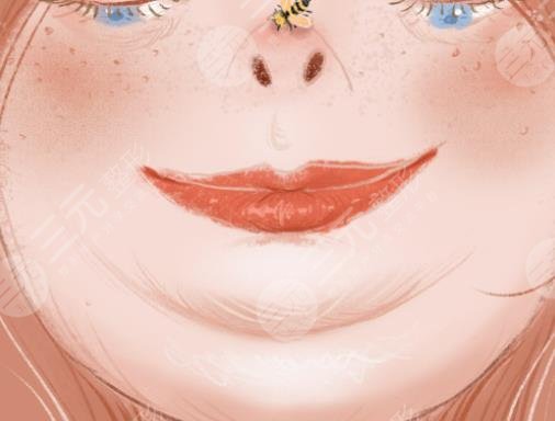 雙下巴