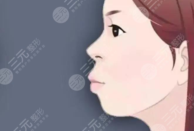 嘴凸矯正