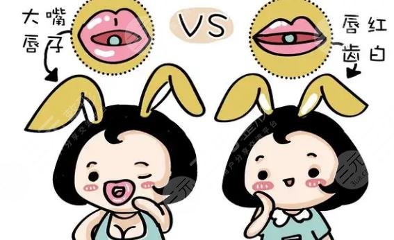 厚唇