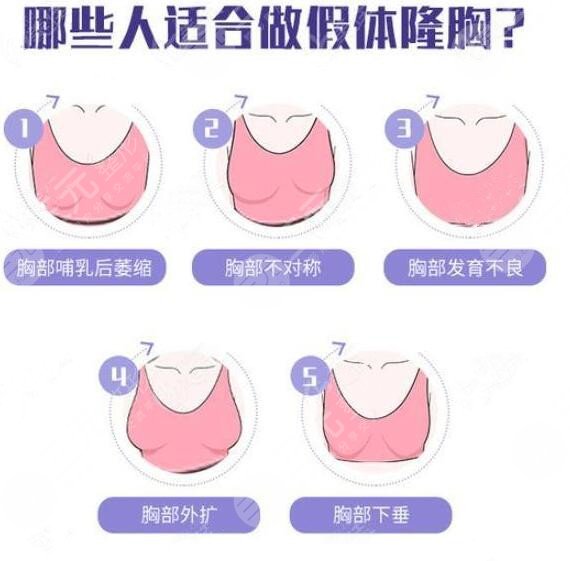 假體隆胸手術(shù)是不是的?