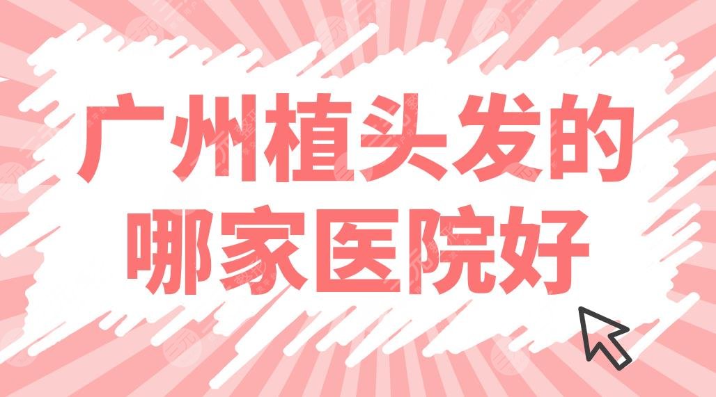 廣州植頭發(fā)的哪家醫(yī)院好？植發(fā)醫(yī)院排名前5|仁健、倍生、熙朵等上榜！