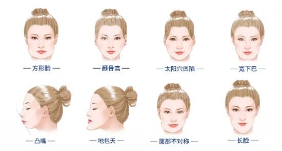 瓜子臉手術