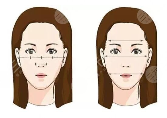 瓜子臉手術