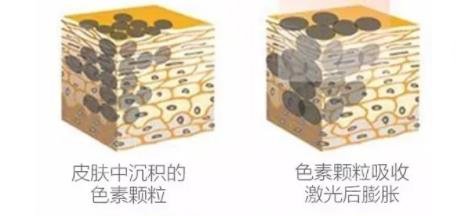 洗眉毛