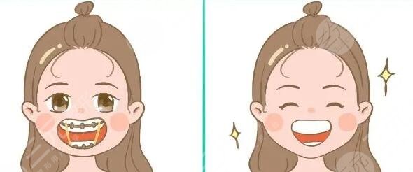 正畸