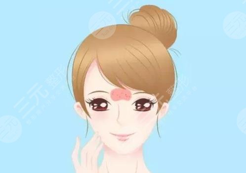 額頭長痘