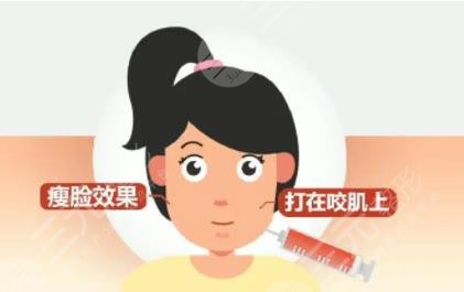 吸脂瘦臉