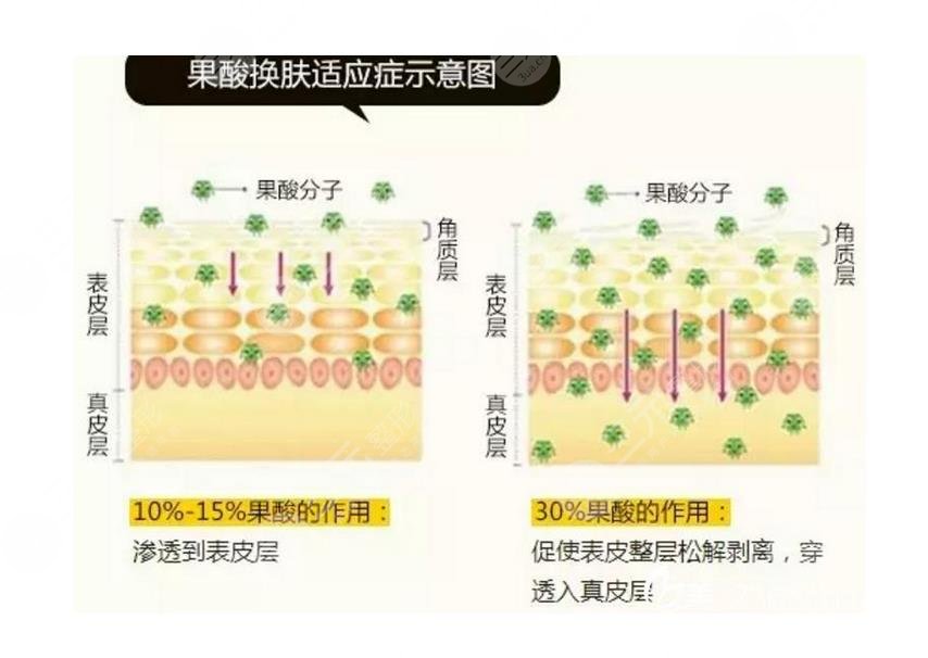 如何有祛斑不反彈?