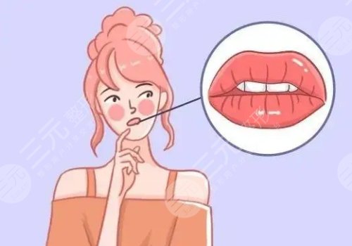 厚唇變薄手術(shù)多少錢？