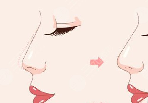 超龍醫(yī)療美容醫(yī)院怎么樣?